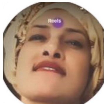 Profile photo