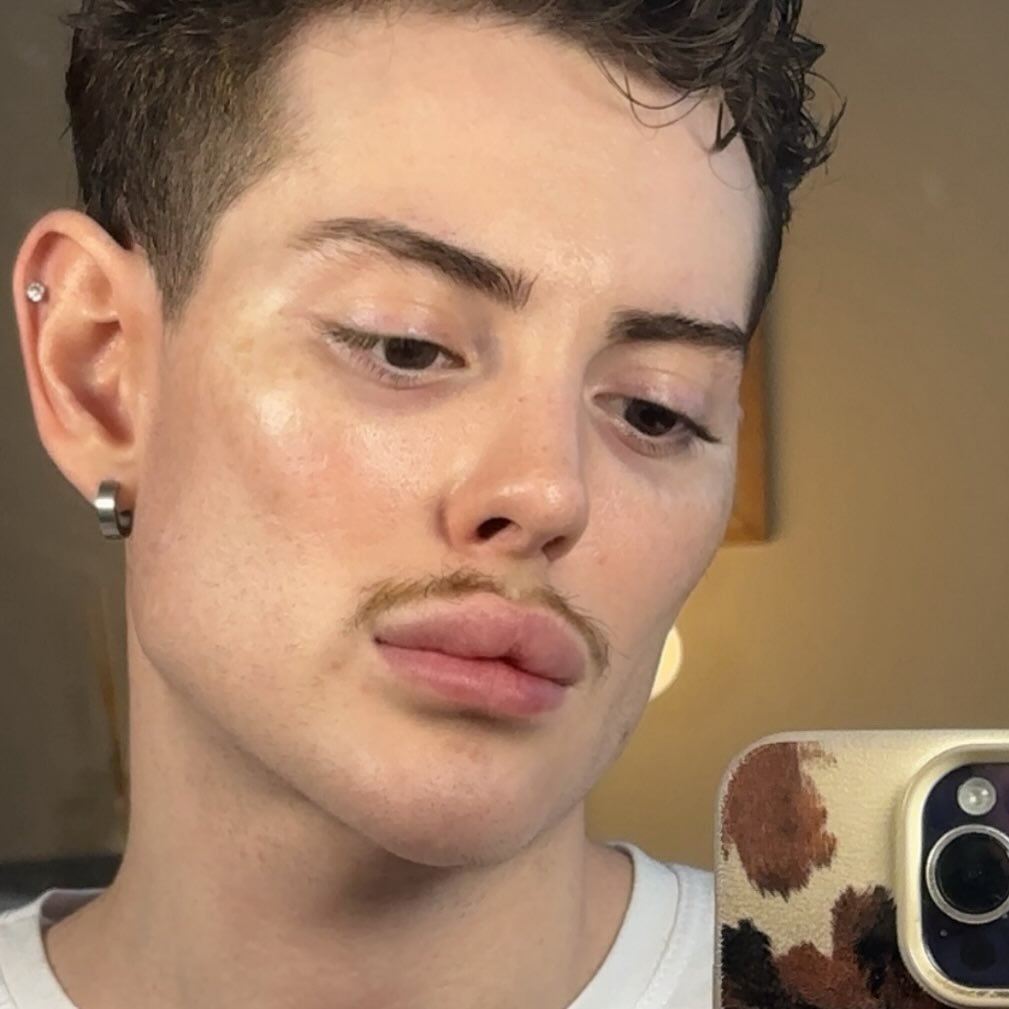 Profile photo