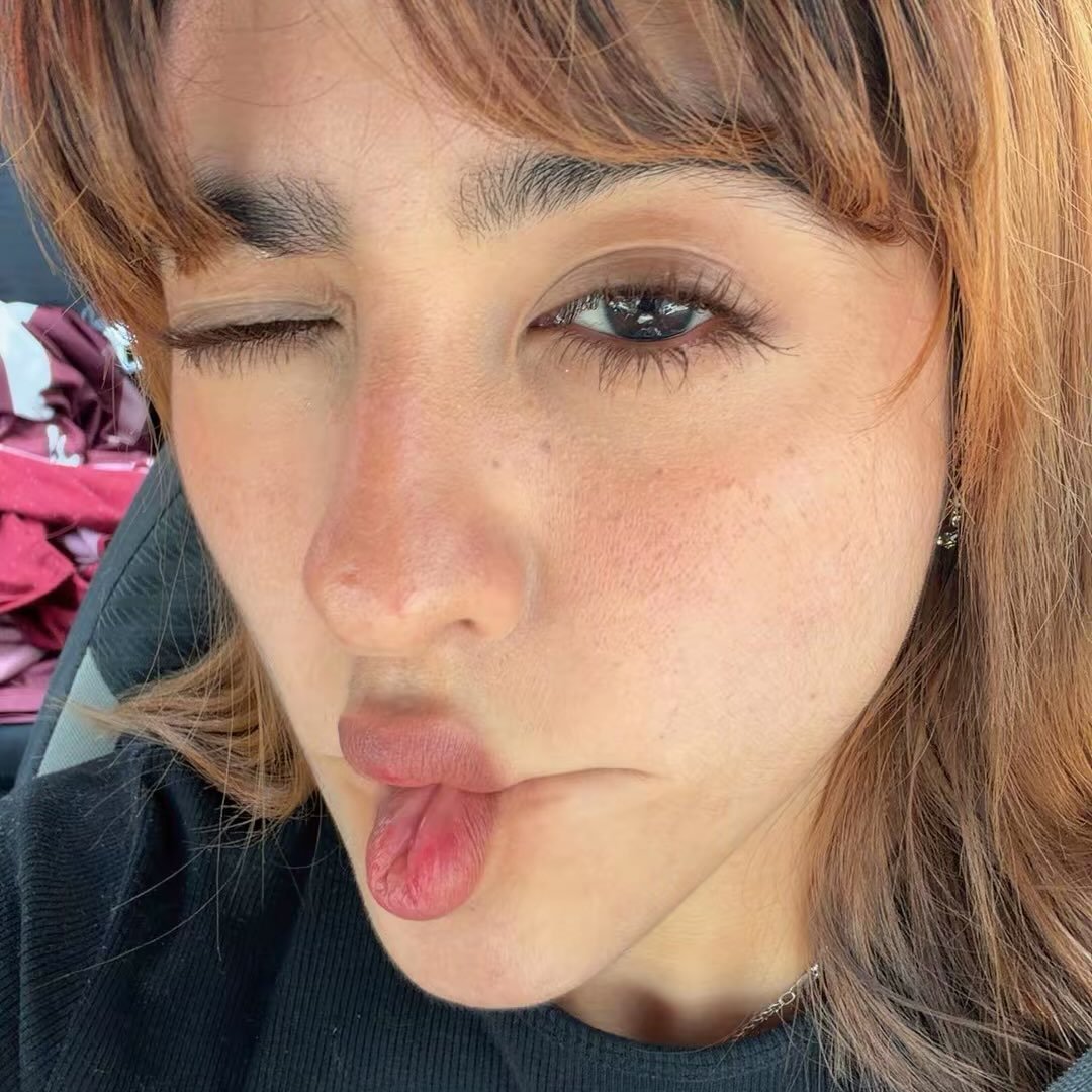 Profile photo